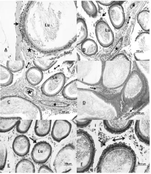 Figura  6.  Fotomicrografia,  corte  transversal  de  epidídimo  de  rato  Sprague-Dawley  dos  grupos:  Grupo  Nandrolona  -  GN  (A)  cabeça  transição  com  corpo,  Grupo  Nandrolona/Exercício  -  GNE  (em  B  e  C)  cabeça  e  corpo,  Grupo  Exercício 