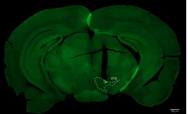 Figure 7.2 Representative images of the gradient refractive index ( GRIN ) lens track in the ventral tegmental  area (VTA)