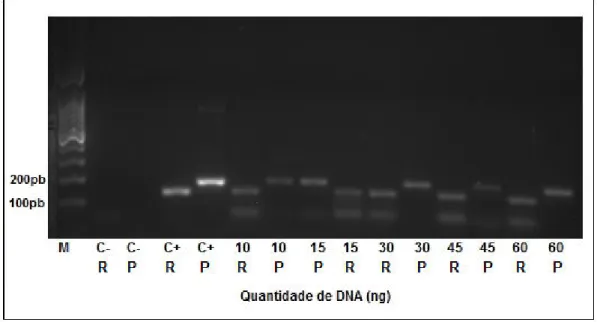 Figura  6:  Avaliação  da  quantidade  inicial  de  DNA  de  amostras  parafinadas  para  amplificação  por  PCR  na  avaliação  do  polimorfismo  R72P  do  gene  TP53