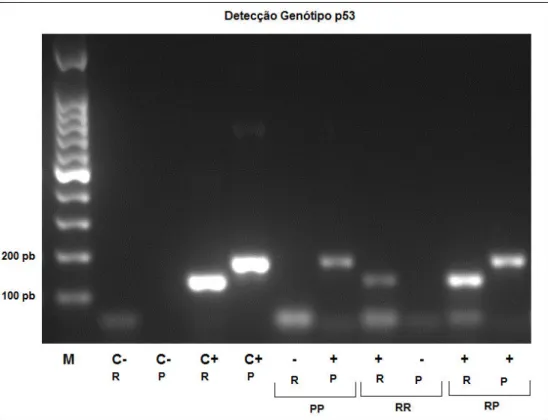 Figura  7:  Gel  de  agarose  representativo  da  análise  do  polimorfismo  R72P  do  gene  TP53  por  PCR  alelo  específica
