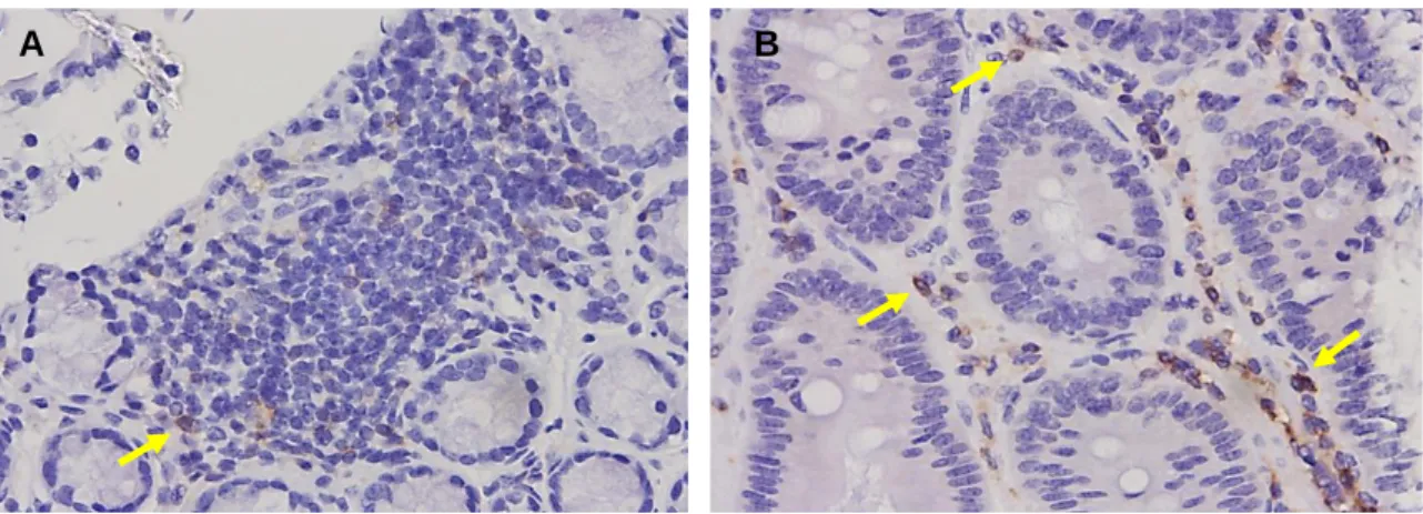 Figure  19  -  Representative  CD4  staining  (brown)  in  untreated  (A)  and  treated  (B)  intestinal  tissue  (400x  magnification)