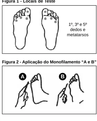 Figura 2 - Aplicação do Monofilamento “A e B”