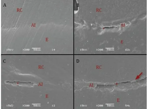 Figure 3: Scanning Electronic Microscopy of Protect B adhesive before (A) and after (B) thermal cycling with etched  enamel and before (C) and after (D) thermal cycling without etching