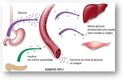 Figura 4: Mecanismo da glicose/insulina em paciente com diabetes tipo 1. 