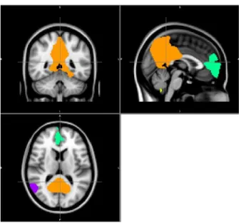 Figure 4. Functional activation patterns of the default mode network. 