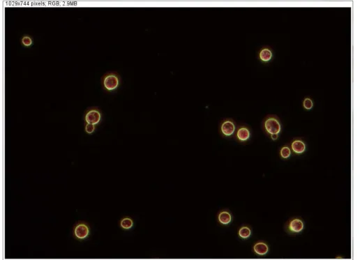 Figure 4.2 and 4.3 shows two original images where the ScerevisiCounter plugin was applied