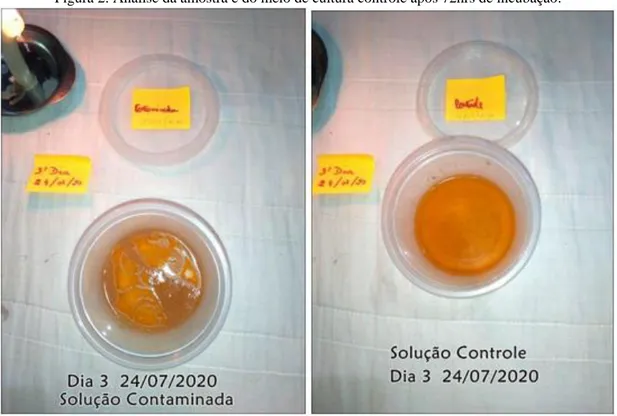 Figura 2: Análise da amostra e do meio de cultura controle após 72hrs de incubação. 