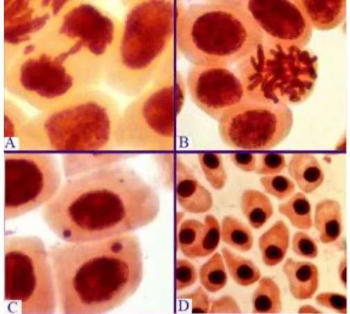 Figura 1 - Alterações nucleares observadas em células meristemáticas de raiz de A. cepa