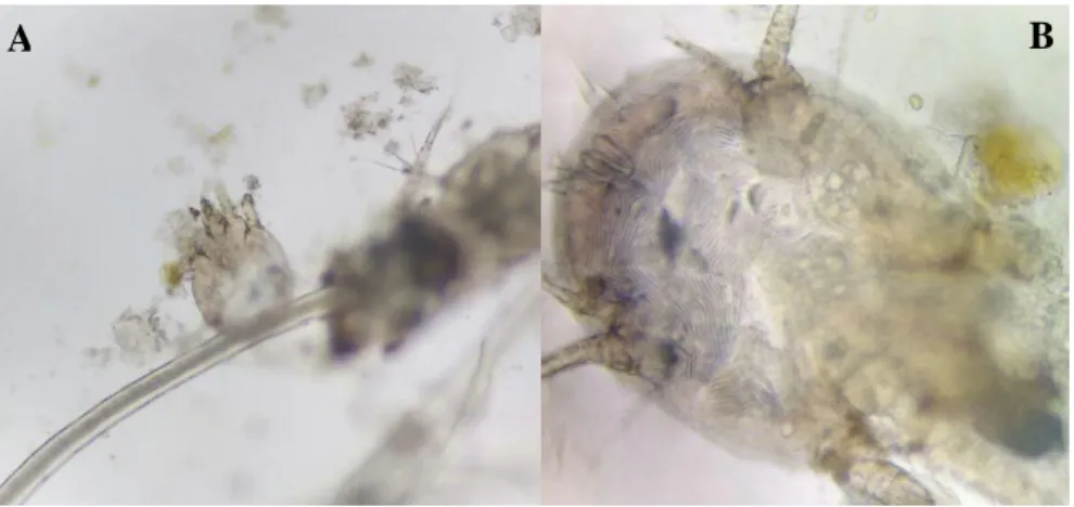 Figura 1: A- Presença de forma adulta do ácaro Psoroptes sp. em exame direto de raspado de  pele  em  equino  em  microscopia  óptica