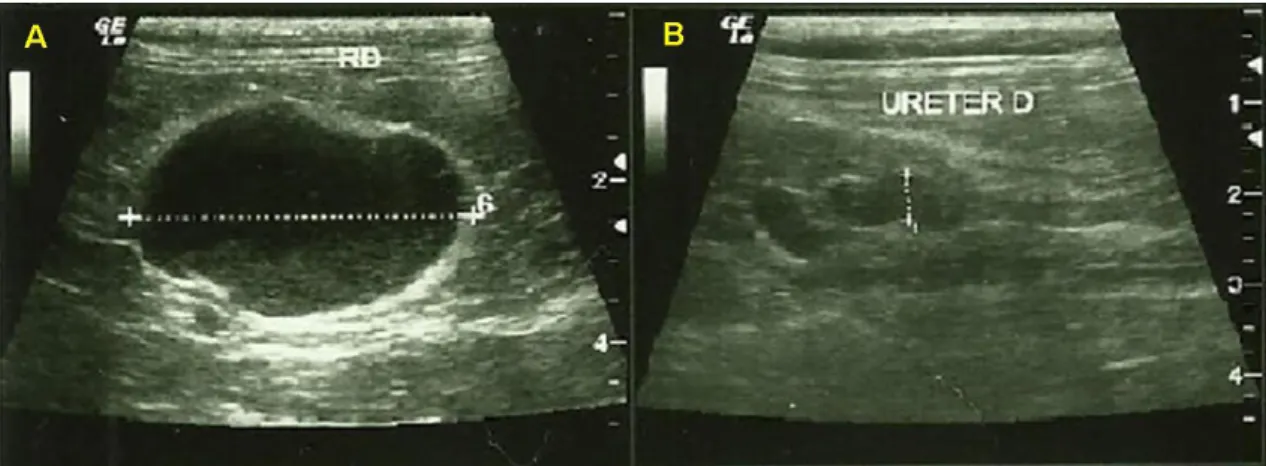 Figura 2 –  Quadro dos resultados dos hemogramas realizados em 21 de outubro  de 2013, de gato macho srd de doze anos de idade com hidronefrose por trauma  em ureter