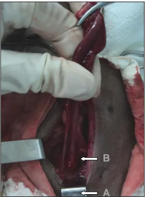 FIGURA  1  –  A  foto  apresenta  a  exposição  da  cérvix  (A)  com  ausência  da  bifurcação  dos  cornos  uterinos,  mostrando  apenas  o  corno  direito  (B)  em  cadela  Dachshund  com  agenesia  de  corno  uterino  esquerdo  submetida  à  ovarioister