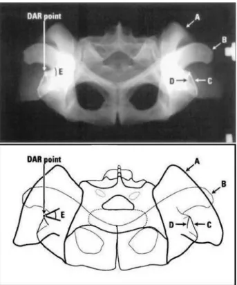 Figura  3:  Radiografia  craniocaudal  do  bordo  acetabular  dorsal  (DAR)  de  uma  pelve  canina  com  a  anatomia  acetabular  realçada  com  pasta  de  bário  e  sua  linha  desenhada  associada