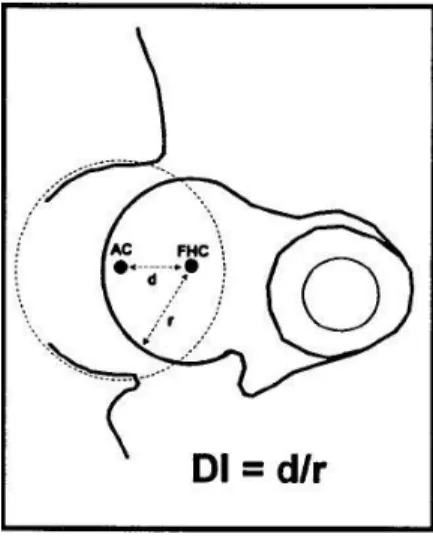 Figura 2: Esquema para mensuração do ID. O índice é calculado pela distância (d) do  centro da cabeça femoral (FHC) do centro do acetábulo (AC) dividido pelo raio (r) da  cabeça femoral (ID = d/r) (Fonte: FLÜCKIGER et al., 1999)