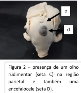 Figura  2  –  presença  de  um  olho  rudimentar  (seta  C)  na  região  parietal  e  também  uma  encefalocele (seta D)