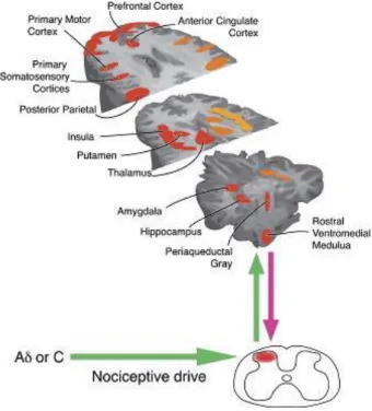 Figure 3 – Brain areas activated during an acute  painful  experience.  Orange  areas  represented  bilaterally  activation  in  the  brain;  red  areas  means areas activated contralaterally; and yellow  areas  are  activated  ipsilaterally  (Tracey  and 