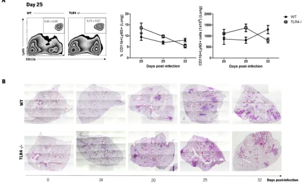 Figure 7 – TLR4 triggering by 02-171 Mtb strain does not impact lung neutrophil accumulation neither  lung inflammation