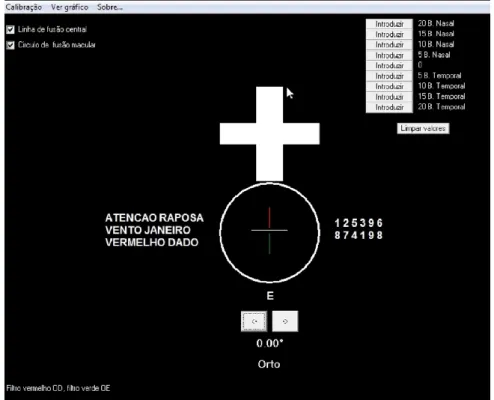 Figura 4 - Teste de disparidade de fixação VDUET. 