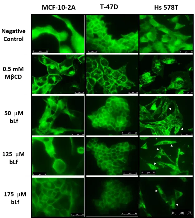 Figure  II.5:  Distribution  of  cholesterol-rich  lipid  rafts  in  breast  cells  exposed  to  bLf