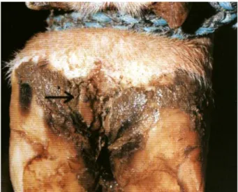 Figura 1. Dermatite interdigital, causada por  Dichelobacter nodosus em provável  sinergismo com Fusobacterium necrophorum  e  Spirochaetas