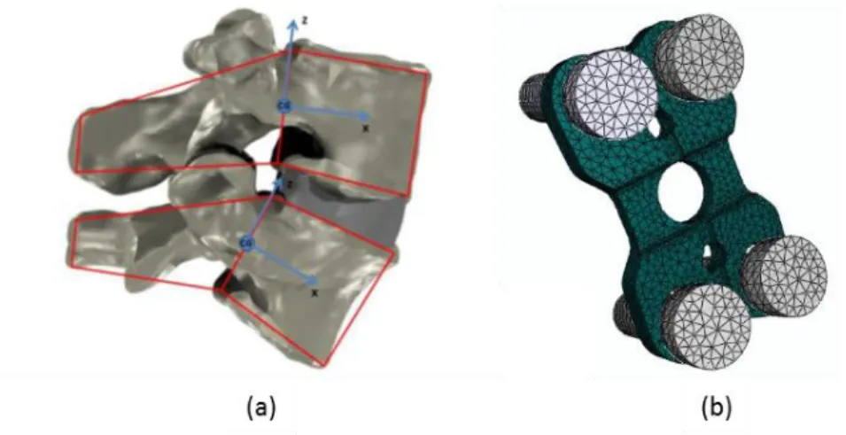 Figure 1.17 - Cristophy's three-dimensional musculoskeletal model with 238 muscles, 13 rigid bodies and 5 intervertebral joints: 
