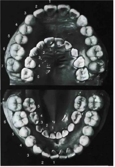 Figura 1- Representação da dentição primária e permanente [6] 