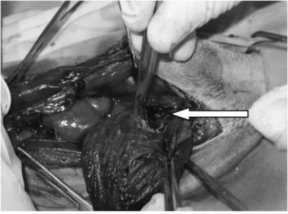 FIGURA 2: Fotografia ilustrativa da uretrostomia pré- pré-púbica com a sonda saindo pela uretra
