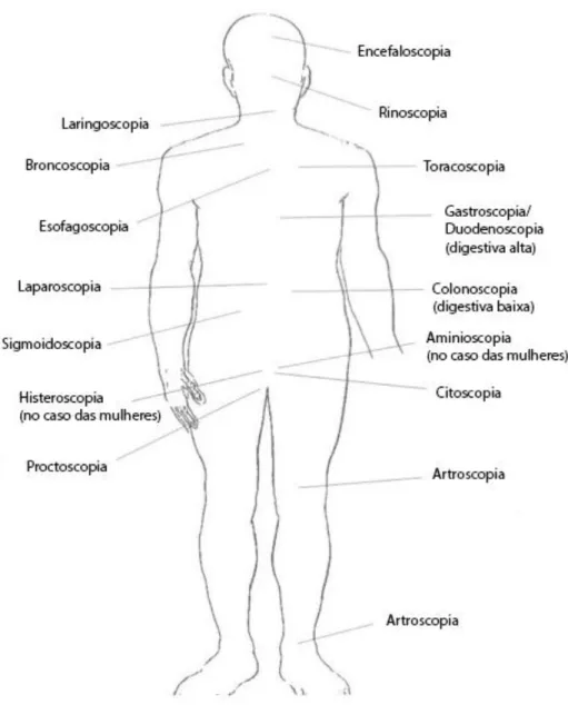 Figura 1.1 Áreas passíveis de exame usando técnicas endoscópicas (adaptado de [11]) 