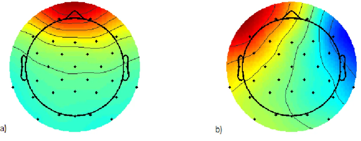 Figura 20. Mapas topográficos padrão das componentes independentes dos a) artefactos oculares piscar de olhos (mapa topográfico à  esquerda) e b) sacadas oculares (mapa topográfico à direita)