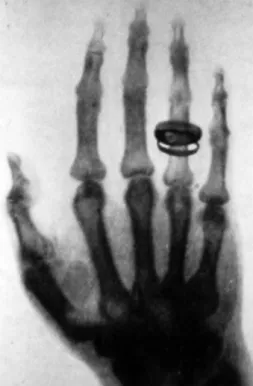 Figura 2.1: Primeira radiografia de Röentgen [14].
