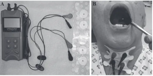Fig. 1. (A) The VitalStim ®  equipment. 