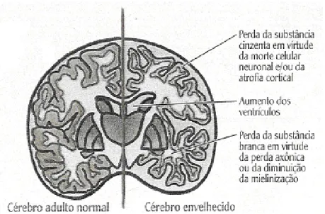 Figura  1 – Diferença  entre o cérebro normal e o cérebro envelhecido Fonte: 