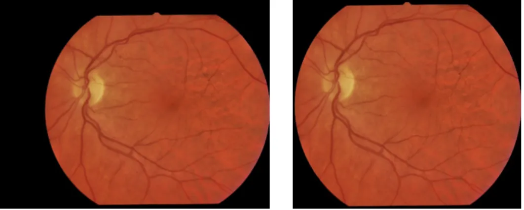 Figure 2.1. The original image (left) and its resized version (right)