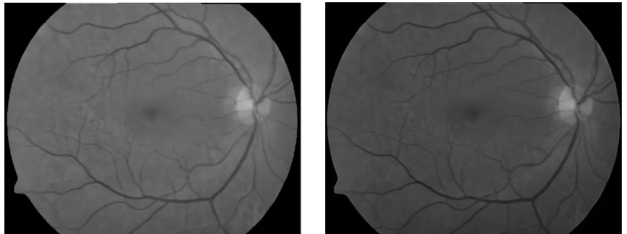 Figure 3.1. A greyscale using MATLAB (left) and a darker greyscale created using OpenCV from the same image (right).