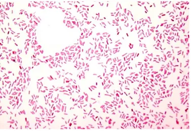 Figura 3.1 - Células de E. coli vistas ao microscópio após  coloração de Gram (imagem retirada do website people.upei.ca).