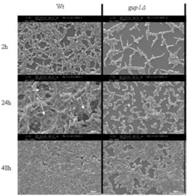 Figure  7  Cagup1Δ  null  mutation  causes  less  and  differently  structured  time-course  biofilm  formation.SEM micrographs of time course biofilm formation