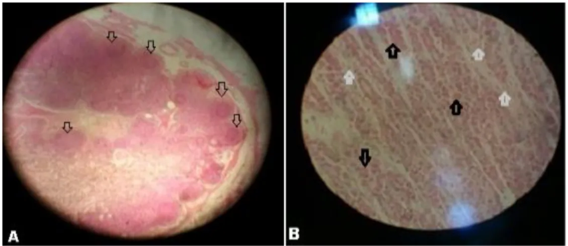 Figura 1 A e 1 B  - Revisão de conteúdos com auxílio de recurso fotográfico, identificando uma porção do  baço e uma região do trato gastrointestinal
