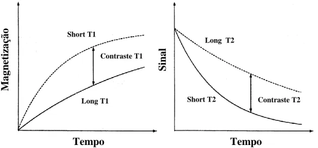 Figura 8 – Os principais mecanismos de contraste em RM, T1 e T2. O gráfico à  esquerda diz respeito ao spin-lattice e pode-se ver como a taxa de recuperação evolui  ao longo do tempo