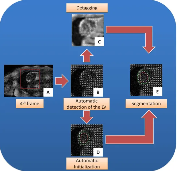 Figure 4.2 - Scheme used for automatic segmentation of LV in t-MRI images. 