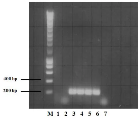 Figure  5  -  PCR  amplification  for  detection  of  the  dextranase  gene  of  oral  streptococcal  species  by  a  PCR  and  a  DNA  probe  (Ssal497T) with Ssal442F and Ssal615R primer pair:  S