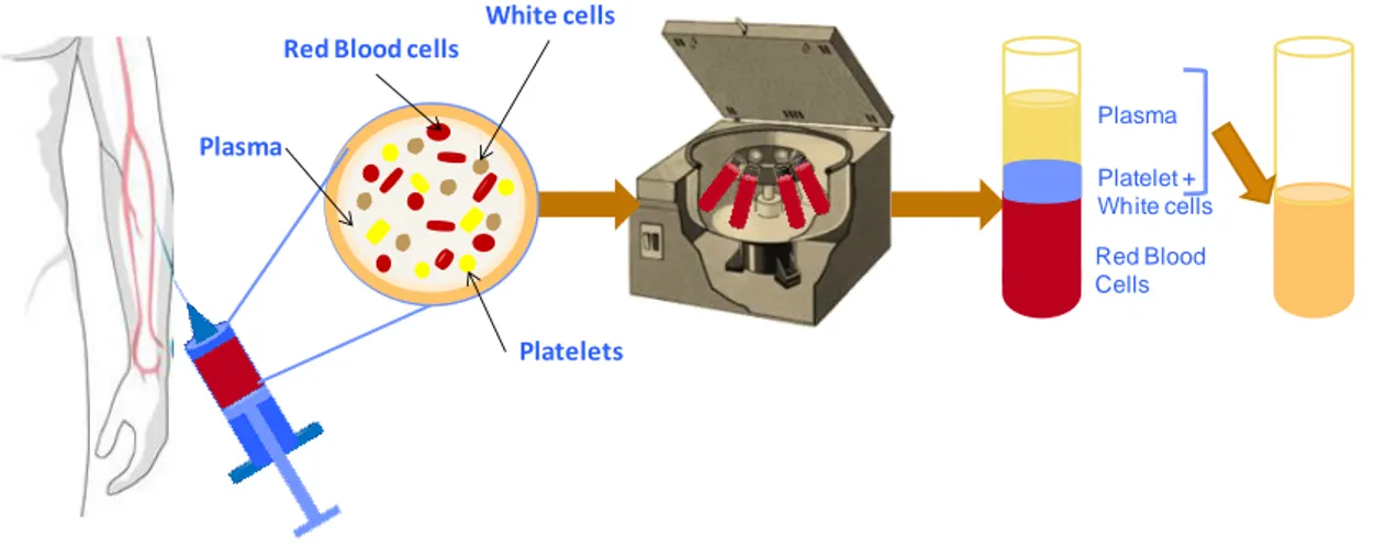Figure 1.3 Schematic representation of the PRP process. In this procedure about 30 to 60 ml of  blood  is  taken  from  the  donor  and  centrifuged  during  15  minutes  and  3200  rpm