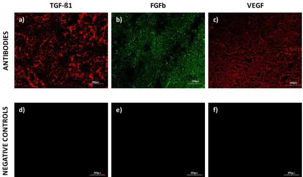 Figure  3.5  Spatial  distribution  of  immobilized  primary  antibodies  at  the  surface  of  activated  and  functionalized electrospun nanofibers