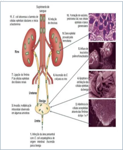 Figura 1 - Patogênese da infecção do trato urinário causado por E. 