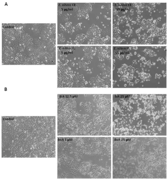 Fig. 13 – Representative images of the effect of different concentrations of  E. nitens  crude extract (CE) and  E