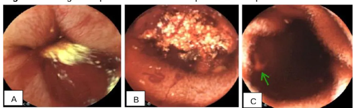 Figura 1 – Imagens capturadas através da cápsula endoscópica. 