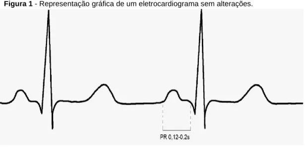 Figura 1 - Representação gráfica de um eletrocardiograma sem alterações. 