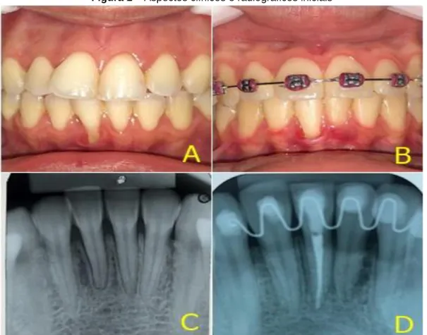 Figura 1 – Aspectos clínicos e radiográficos iniciais 