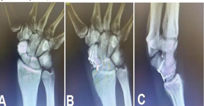 Figura 1 - Radiografia do punho.  