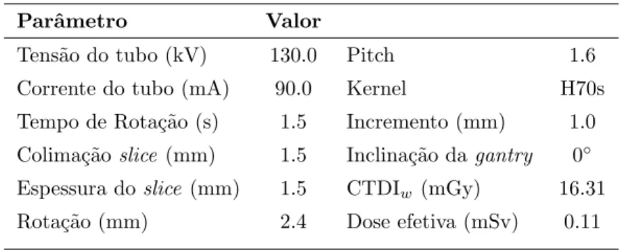 Tabela 3.1: Valores dos parˆ ametros constituintes do protocolo TC Dental.