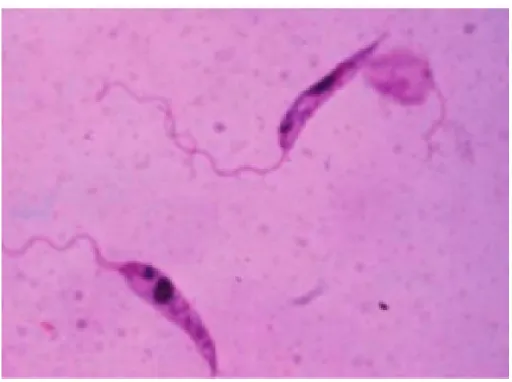 Figura 1: Morfologia da Leishmania SP promastigota.