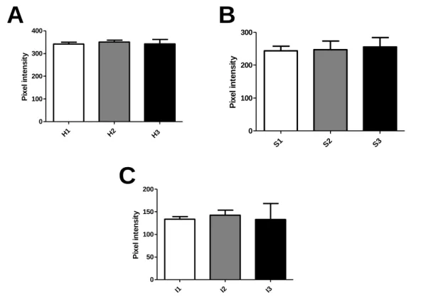 Figure 2 - Calibration of hue (H), saturation (S) and intensity (I) parameters in different  images